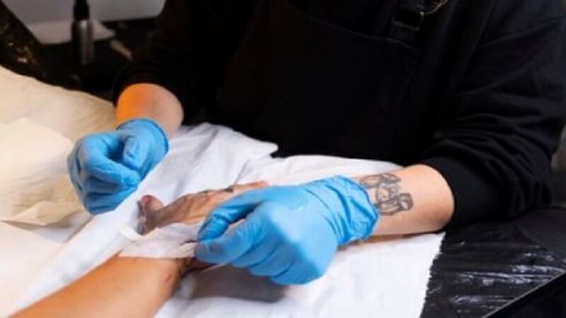 How to Prevent Complications During Tattoo Removal Aftercare